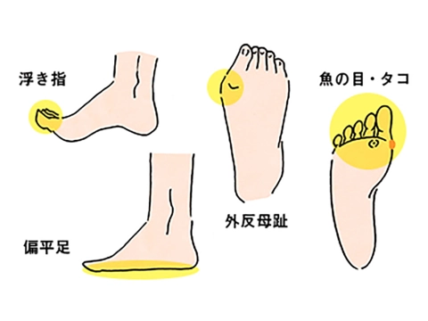 「足裏を見せるのが恥ずかしい」と思っていませんか？