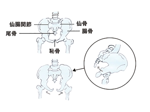 骨盤に起こる変化が体に与える影響