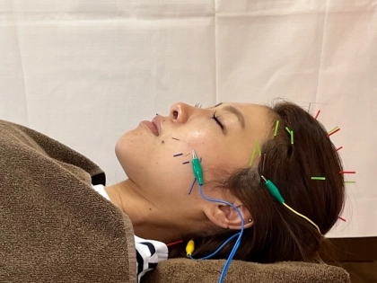りふぁいん鍼灸整骨院の写真3