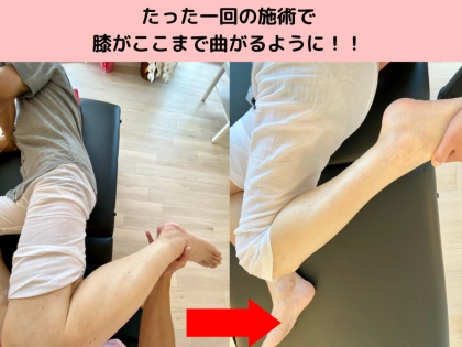 腰と膝と股関節の専門整体院ゴトゆきの写真5