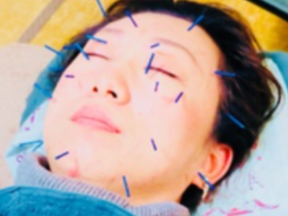 佐々木鍼灸整骨院の写真3